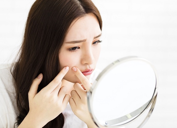 Sản phẩm trị thâm mụn nào tốt? 5 tiêu chí lựa chọn không thể bỏ qua