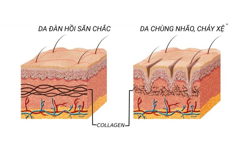 Collagen là gì? 9 tác dụng của collagen với sức khỏe và làn da