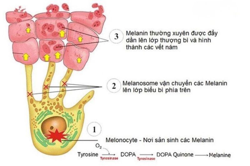 Sắc tố Melanin là gì và có phải là tác nhân khiến da sạm nám?