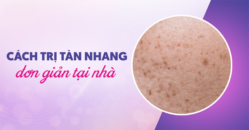 13 cách trị tàn nhang hiệu quả tại nhà, tận gốc nhanh và đơn giản