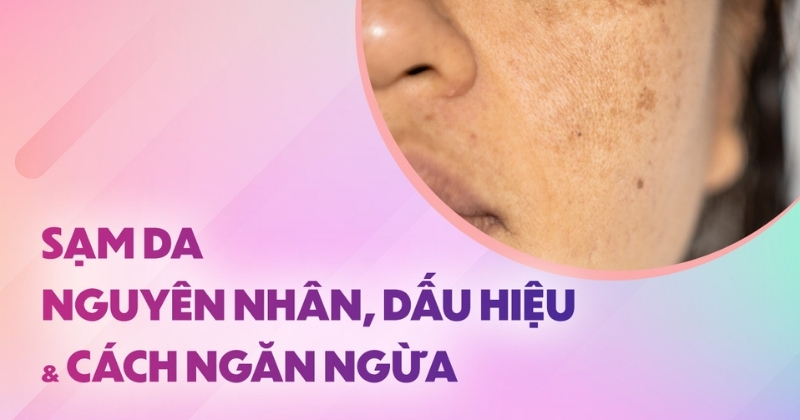sạm da