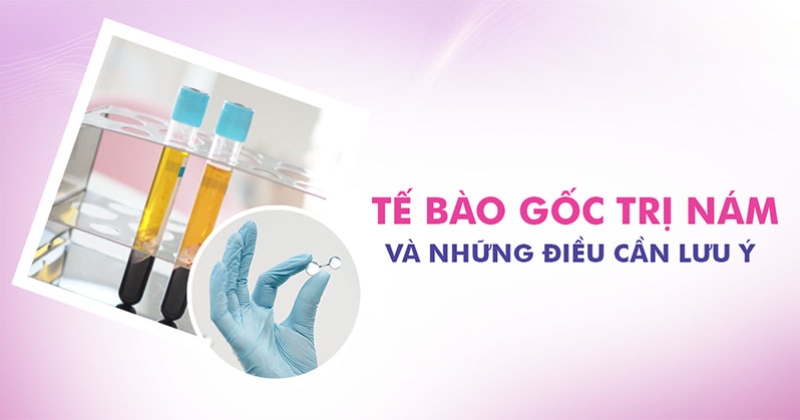 Tế bào gốc trị nám tàn nhang là gì? Có hiệu quả không?