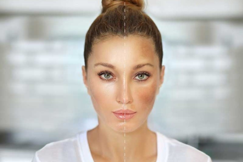 Hướng dẫn các bước chăm sóc da không đều màu hằng ngày