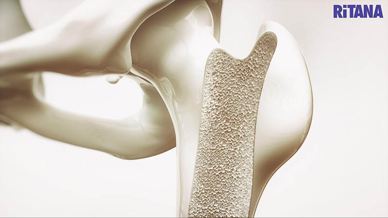 Collagen vừa đủ có thể hỗ trợ ngăn ngừa loãng xương
