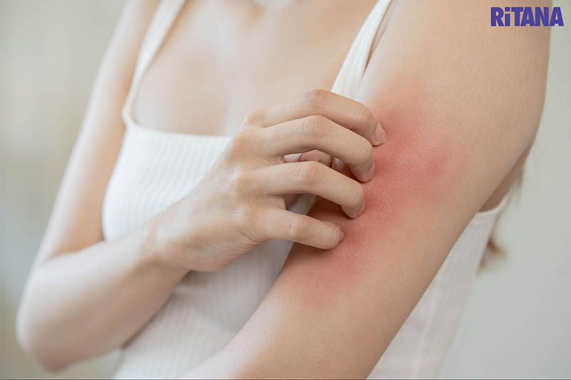 Sử dụng collagen không đúng cách hoặc không phù hợp có thể gây dị ứng