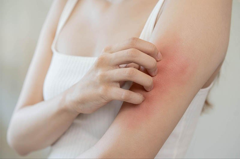 da đỏ ngứa khi dùng collagen