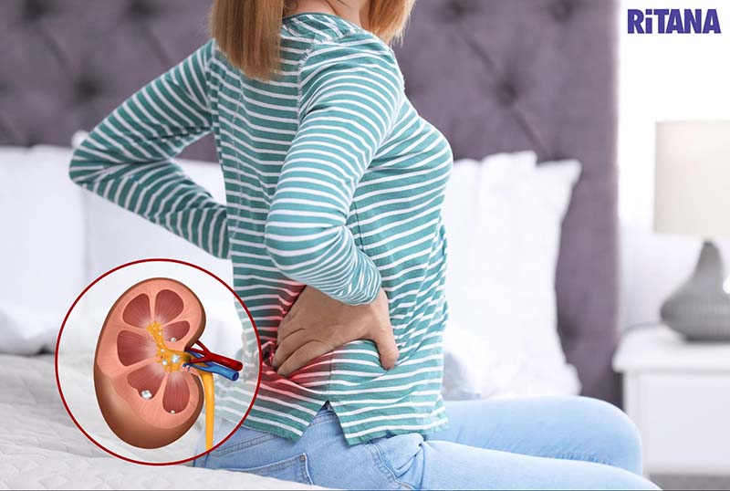 Uống collagen có tác dụng phụ là có thể gây ra sỏi thận
