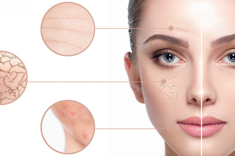 16+ cách trẻ hóa da mặt tự nhiên, hiệu quả cao và an toàn tại nhà