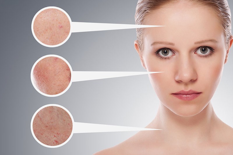 Phục hồi da sau mụn: Quy trình chăm sóc theo từng bước chi tiết