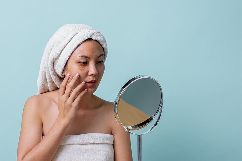 nám da thường gặp ở phụ nữ