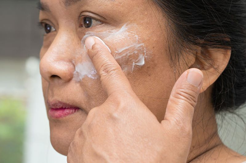 bôi kem trị nám