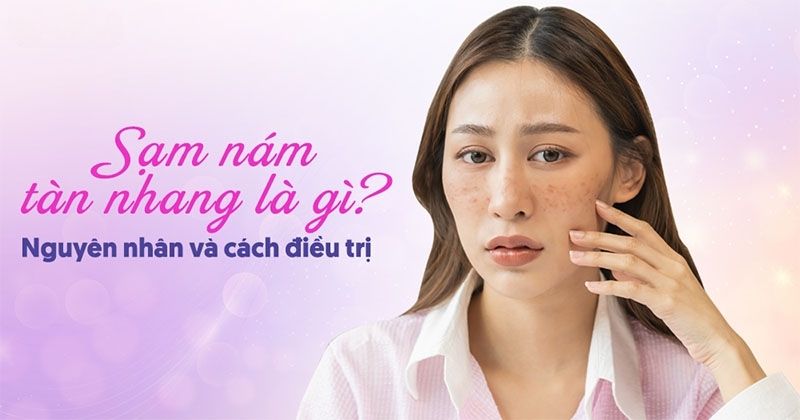 nám sạm tàn nhang là gì
