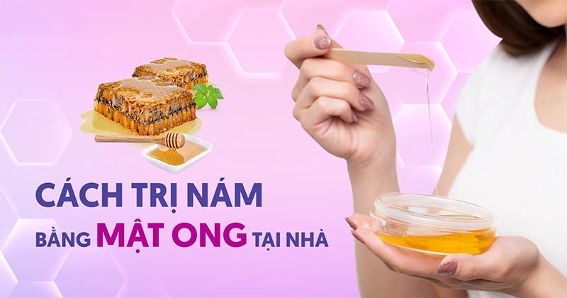12 cách trị nám bằng mật ong tại nhà ít ai biết