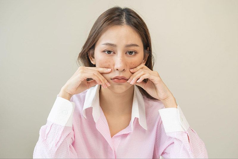 sạm nám tàn nhang là nguy cơ gây lão hóa