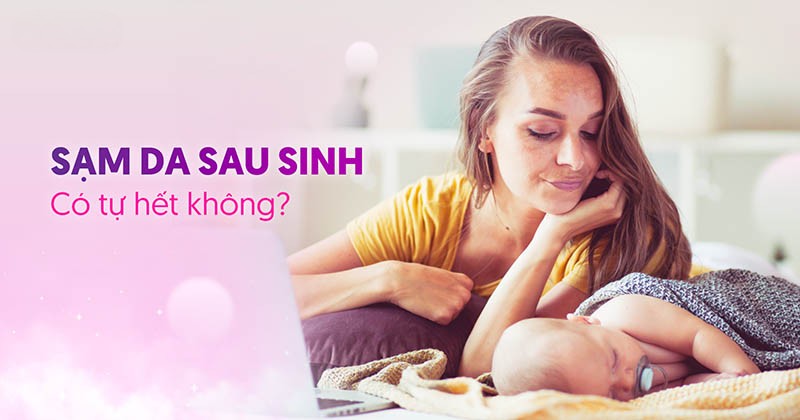 sạm da sau sinh