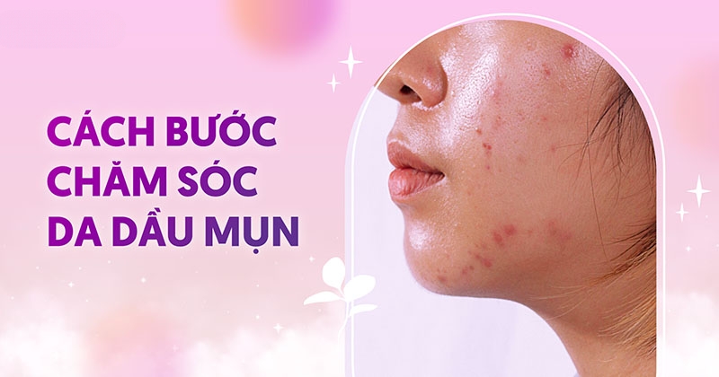 Các bước chăm sóc da dầu mụn hàng ngày từ cơ bản đến chuyên sâu