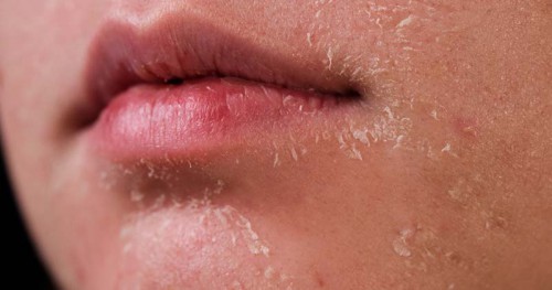 Cách chăm sóc da mùa đông tại nhà và 6 điều bạn nên hiểu rõ!