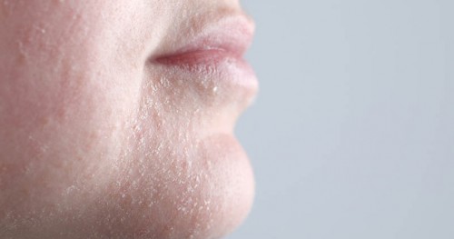 10 cách dưỡng ẩm da mặt mùa đông tại nhà siêu đơn giản