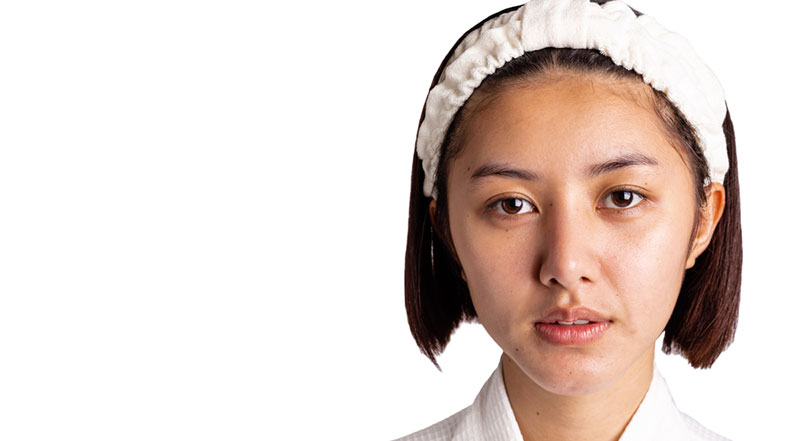 7 nguyên nhân khiến da xỉn màu, thiếu sức sống