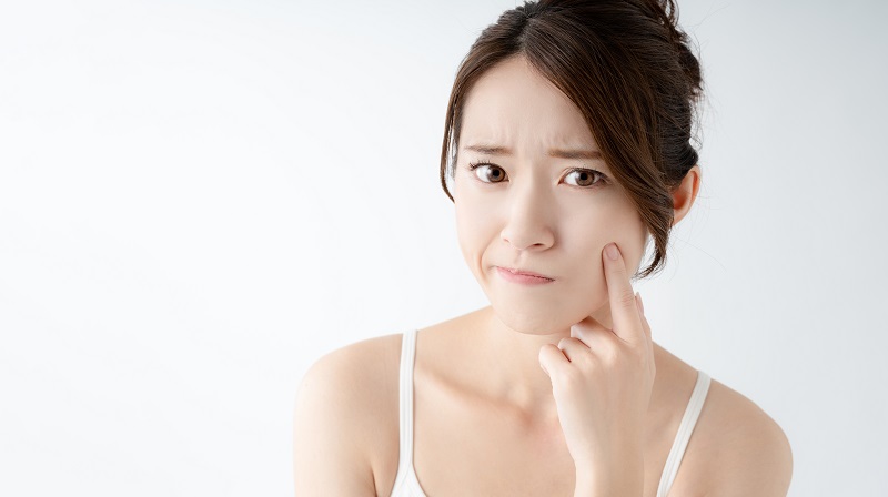Mụn ẩn dưới da là gì? Nguyên nhân và cách phòng ngừa