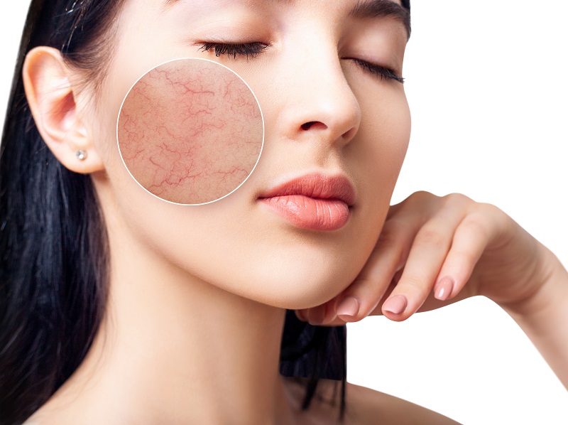 Tẩy tế bào chết cho da nhạy cảm và TOP 5 câu hỏi thường gặp