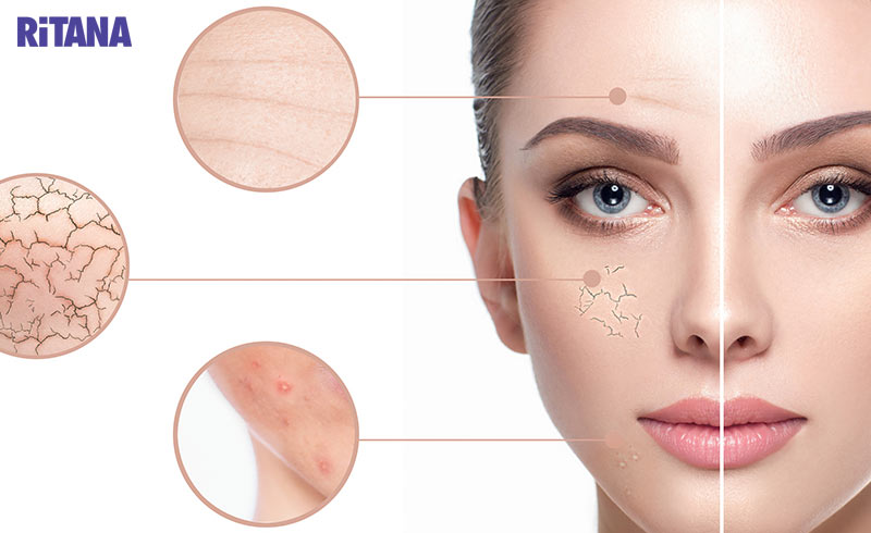 16+ cách trẻ hóa da mặt tự nhiên, hiệu quả cao và an toàn tại nhà
