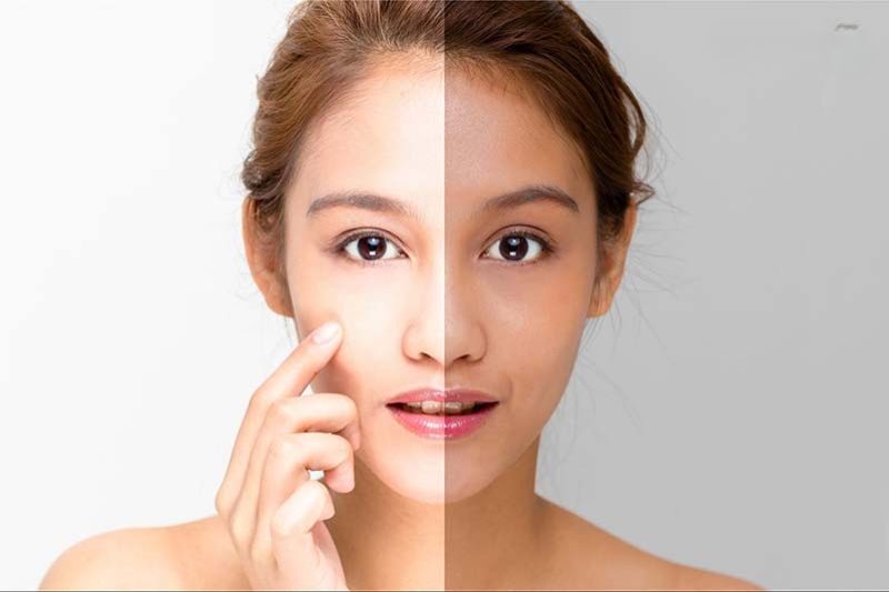 làn da trước và sau khi dùng viên uống trắng da