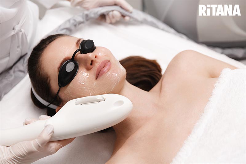 Cách làm trẻ hóa da bằng laser toning
