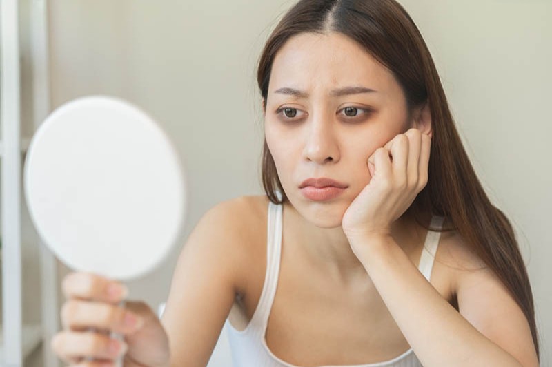 quầng thâm mắt làm cơ thể tiều tụy