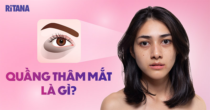 Quầng thâm mắt là gì? Nguyên nhân và cách phòng chống hiệu quả
