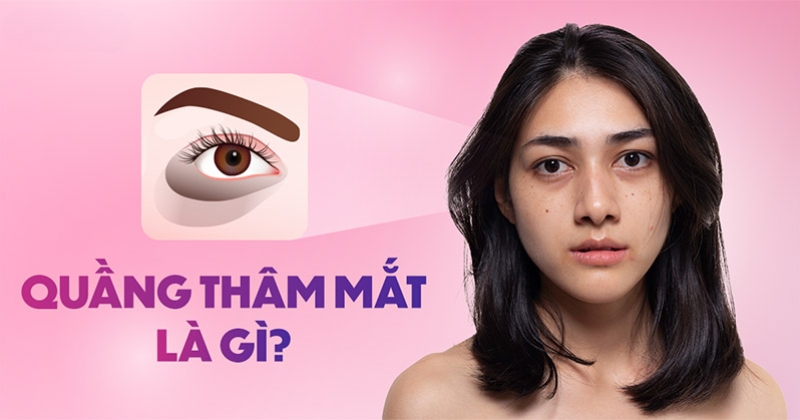 Quầng thâm mắt là gì? Nguyên nhân và cách phòng chống hiệu quả