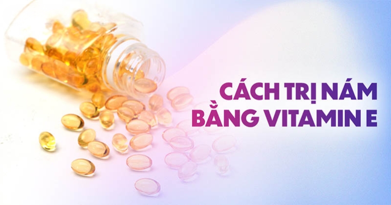 7 cách trị nám bằng vitamin E, xóa sạch nhanh chóng
