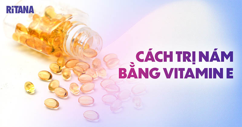 7 cách trị nám bằng vitamin E, xóa sạch nhanh chóng