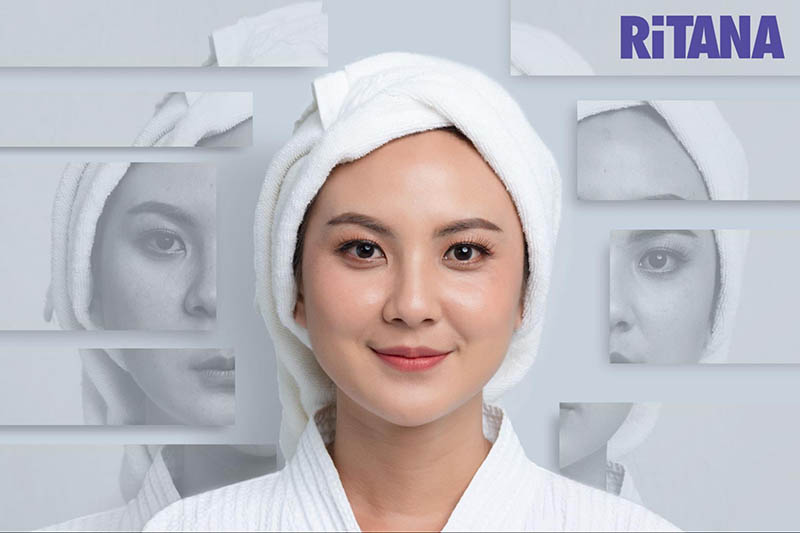 Trị nám bằng laser mang lại hiệu quả cao