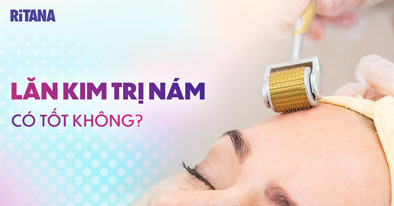 Lăn kim trị nám có tốt không? Hiệu quả như thế nào? Rủi ro ra sao?