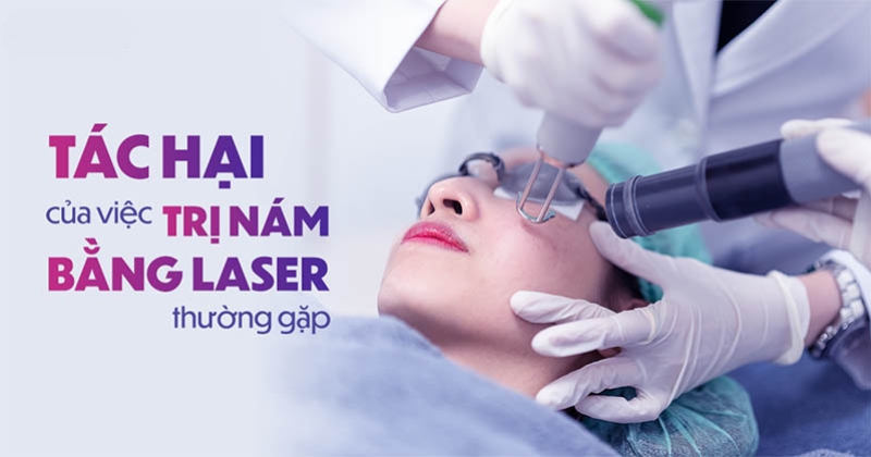 9 tác hại của việc trị nám bằng laser thường gặp bạn có biết