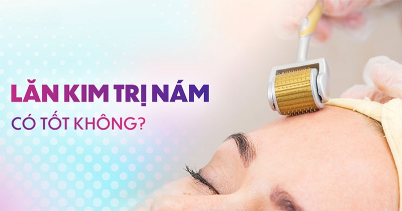 Lăn kim trị nám có tốt không? Hiệu quả như thế nào? Rủi ro ra sao?