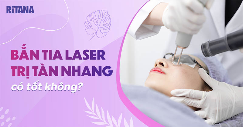Bắn laser trị tàn nhang có tốt không? Có hết được không?