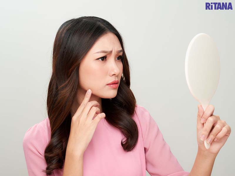 Biểu hiện của da mặt nám đen