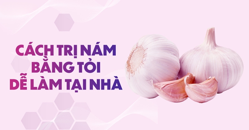 7 cách trị nám bằng tỏi hiệu quả, tốt cho da ngăn ngừa mụn