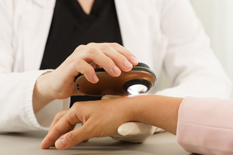 da tay bị sạm nên đi khám nhé