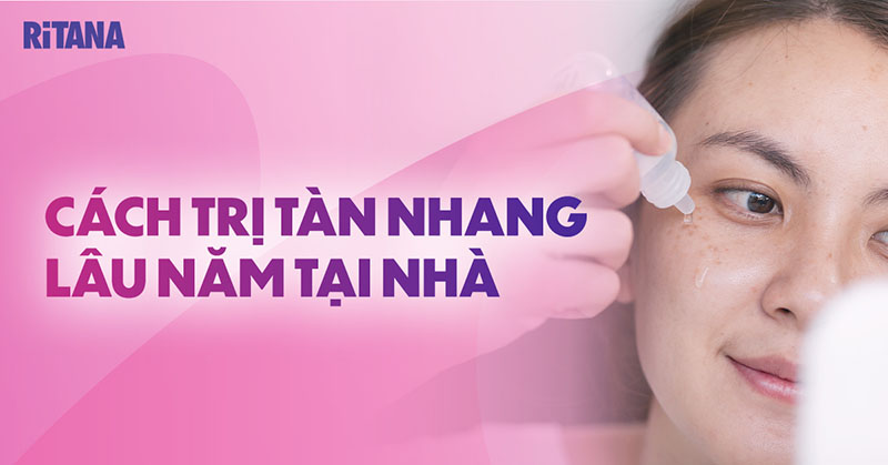 10 cách trị tàn nhang lâu năm tại nhà hiệu quả bạn nên tham khảo