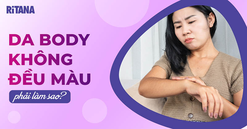 Da body không đều màu phải làm sao? Nguyên nhân do đâu?