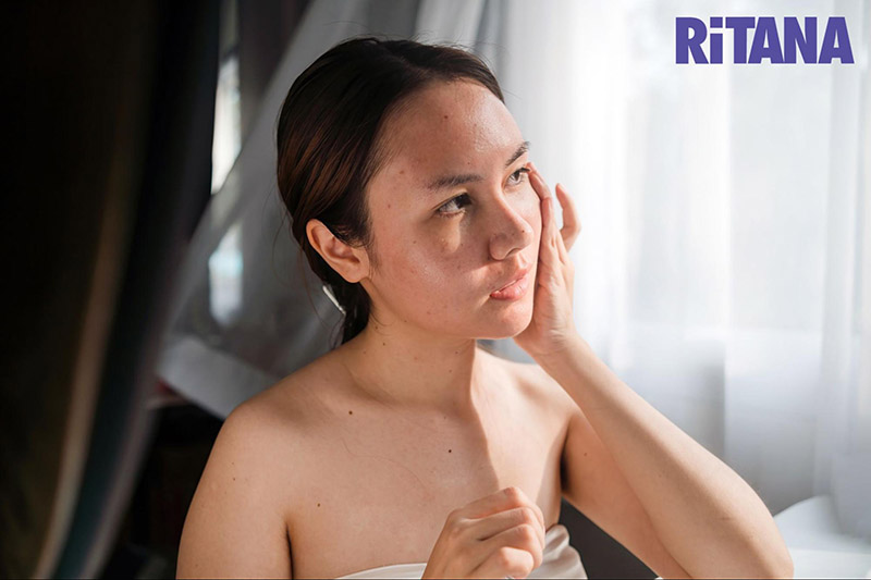 Da body không đều màu do nhiều nguyên nhân gây ra
