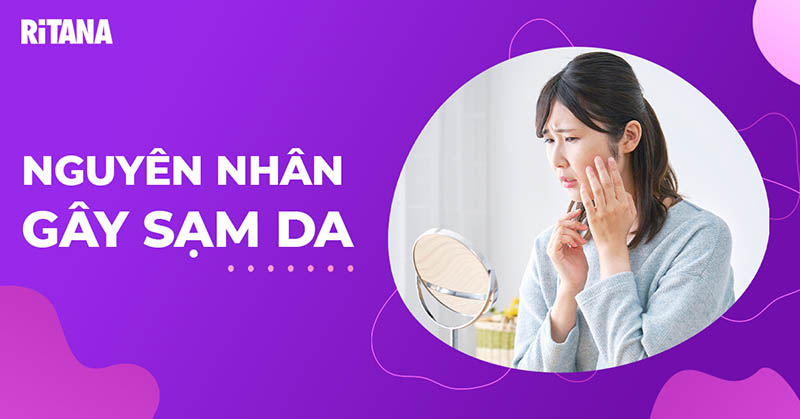 11 nguyên nhân gây sạm da mặt ở phụ nữ phổ biến hiện nay