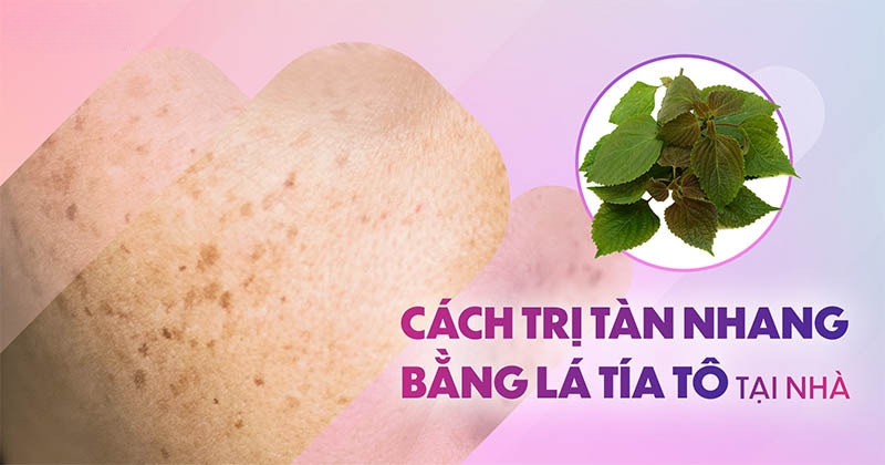 10 cách trị tàn nhang bằng lá tía tô tại nhà hiệu quả cực cao