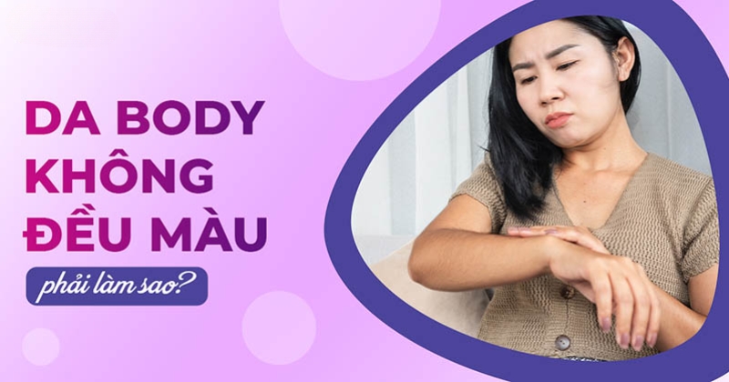 Da body không đều màu phải làm sao? Nguyên nhân do đâu?