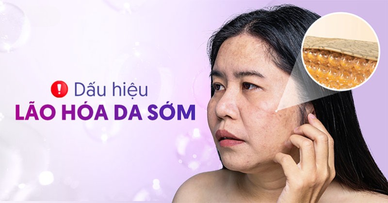 dấu hiệu lão hóa da sớm