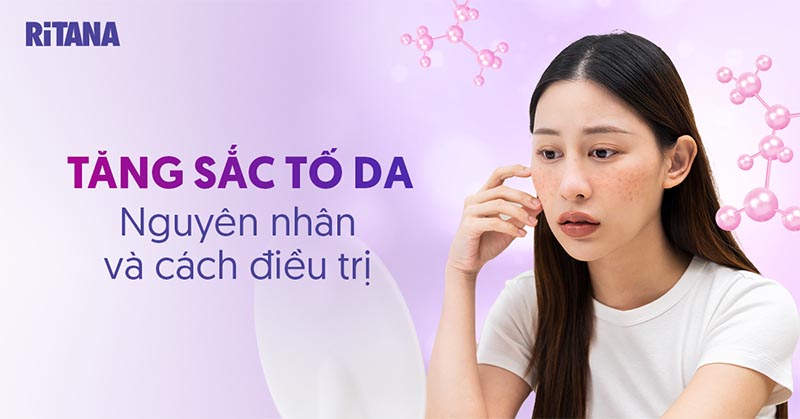 Tăng sắc tố da là gì? Biểu hiện, nguyên nhân và cách điều trị