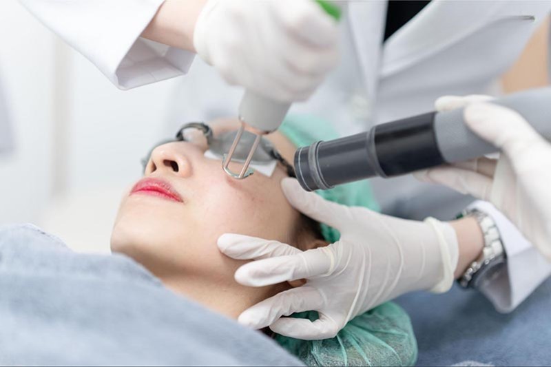 liệu pháp laser giúp ức chế melanin trên da